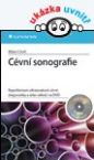 Cvn sonografie Repetitorium ultrazvukov cvn diagnostiky a atlas nlez na DVD